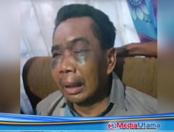 5 Hari Diperiksa di Polsek Percut Sei Tuan, Saksi Pembunuhan Pulang dengan Wajah Lebam