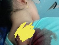 Seorang Wanita Diclurit Pelaku Begal di Jalan Cemara Abadi 