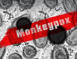 Filipina Catat 18 Kasus Mpox, Angka Terus Bertambah