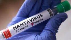 Virus dari Tikus Picu Kekhawatiran Global, Indonesia Catat 23 Kasus Hantavirus